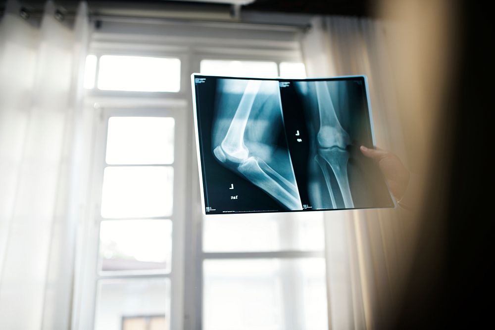 Doctor with a patient's x-ray film