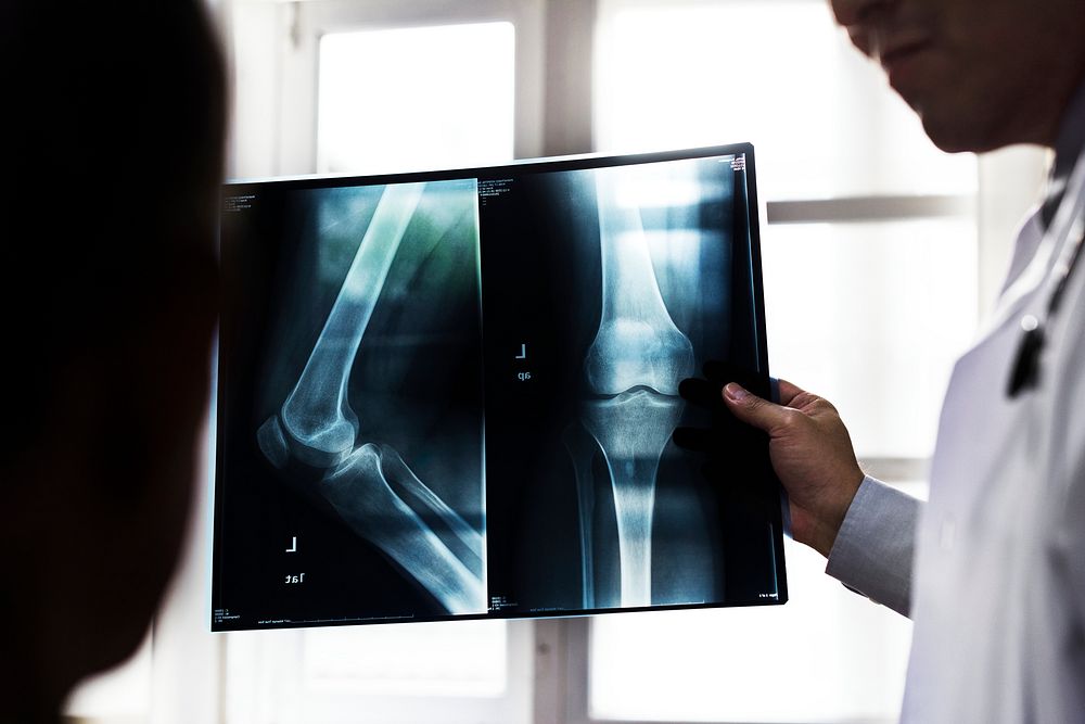 A doctor with a patient's x-ray film