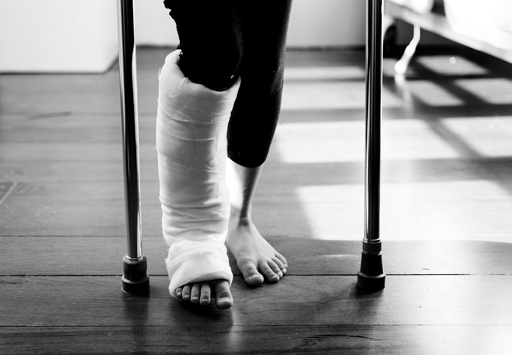 Young Caucasian girl with broken leg in plaster cast
