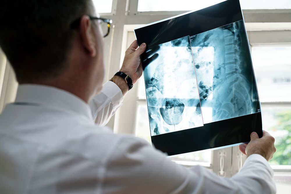Doctor is checking patient x-ray film