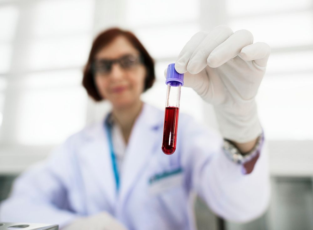 Doctor holding blood sample Free Photo rawpixel