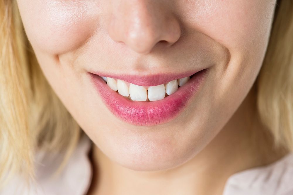 Closeup of smiling woman's teeth