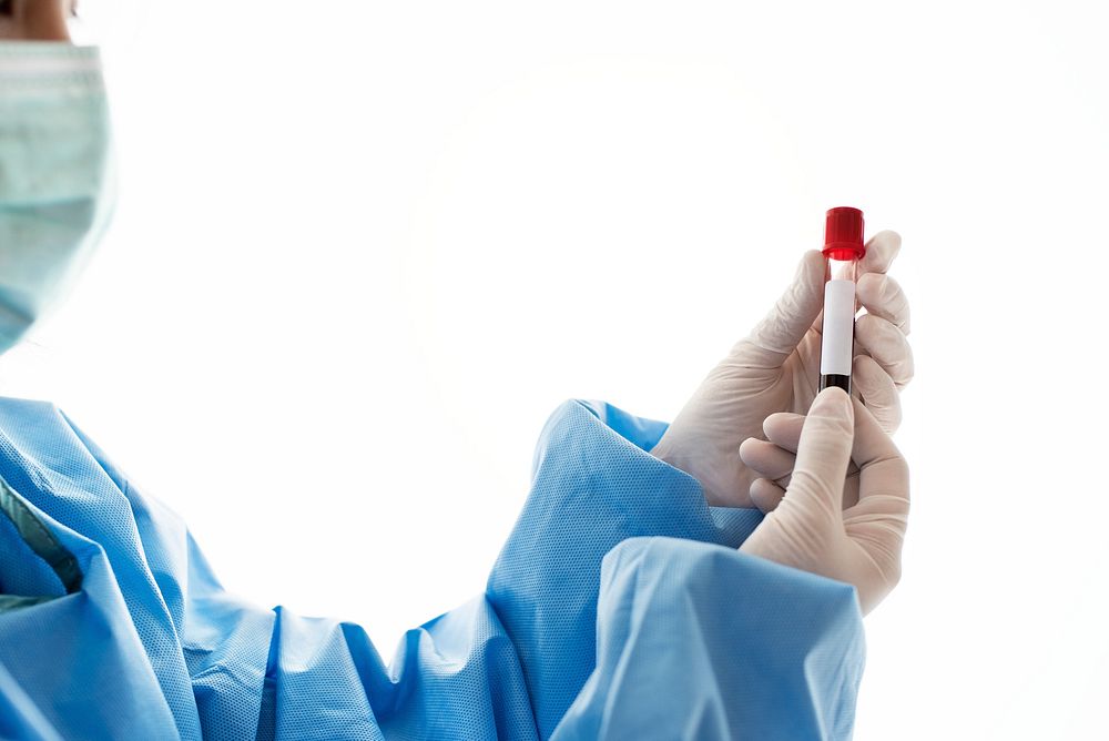 Doctor holding a blood test tube