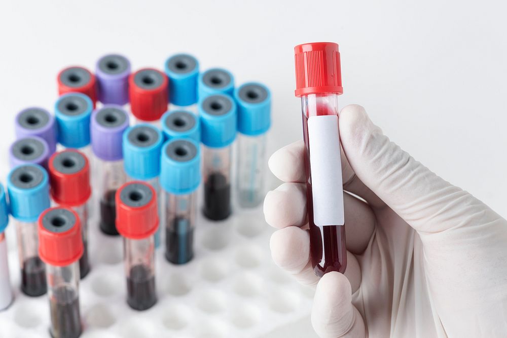 Doctor holding a blood test tube