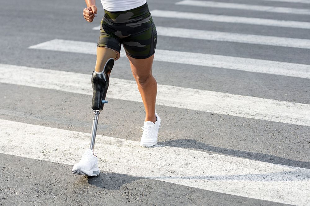 Woman with prosthetic leg crossing the road