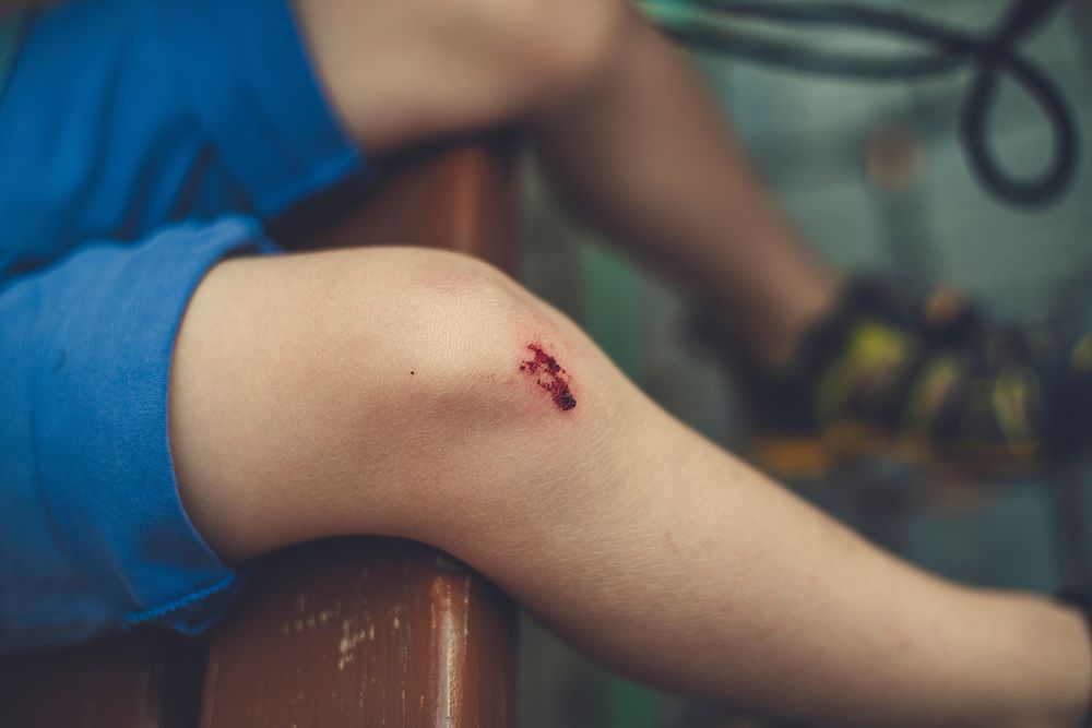 Boy with a bleeding wound on his knee
