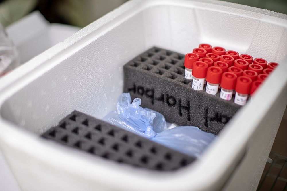 COVID-19 test swabs are placed into a container during COVID-19 testing in San Diego, California, June 22, 2020.