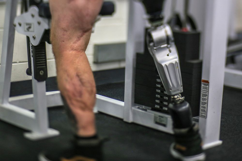 U.S. Marine Corps Cpl. Rory Hamill works out in the base gym on Joint Base McGuire-Dix-Lakehurst, N.J. Scars lining the back…