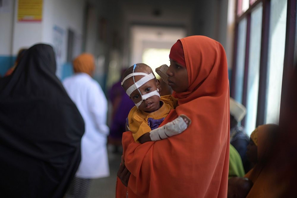 An internally displaced Somali woman holds her malnourished child fitted with a nasogastric tube inside a ward dedicated for…