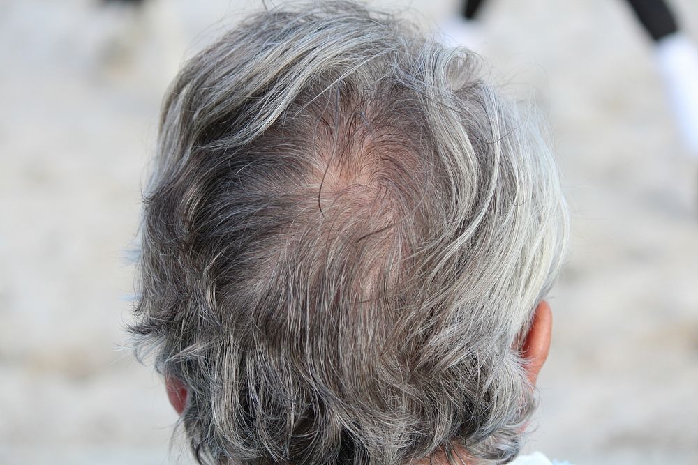 Gray hair on man. Free public domain CC0 photo.