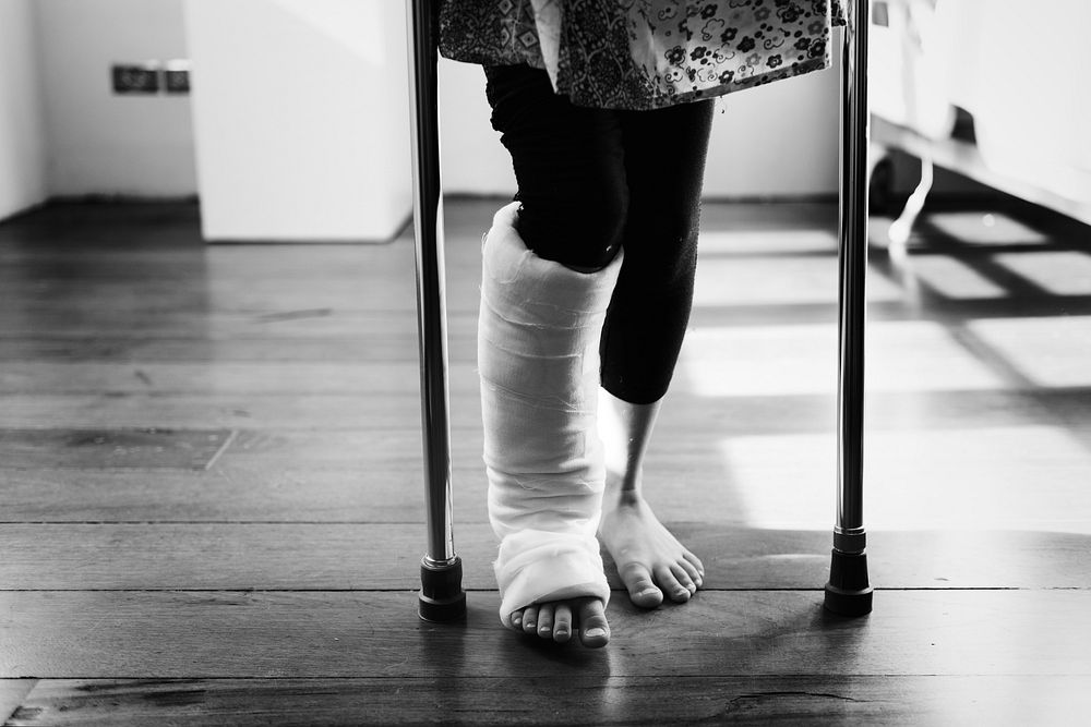 Young girl with a broken leg