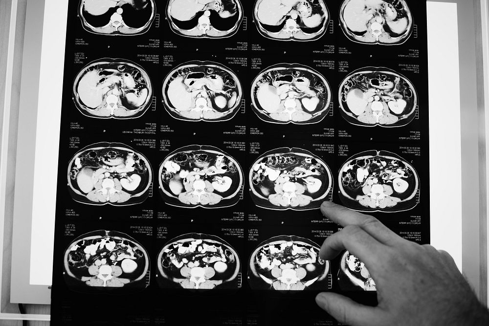 Brain CT scan x-ray film