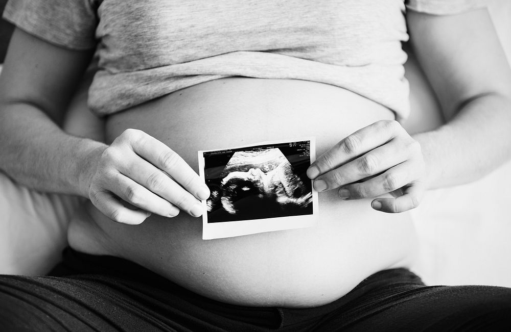 Pregnant woman showing ultrasound photo