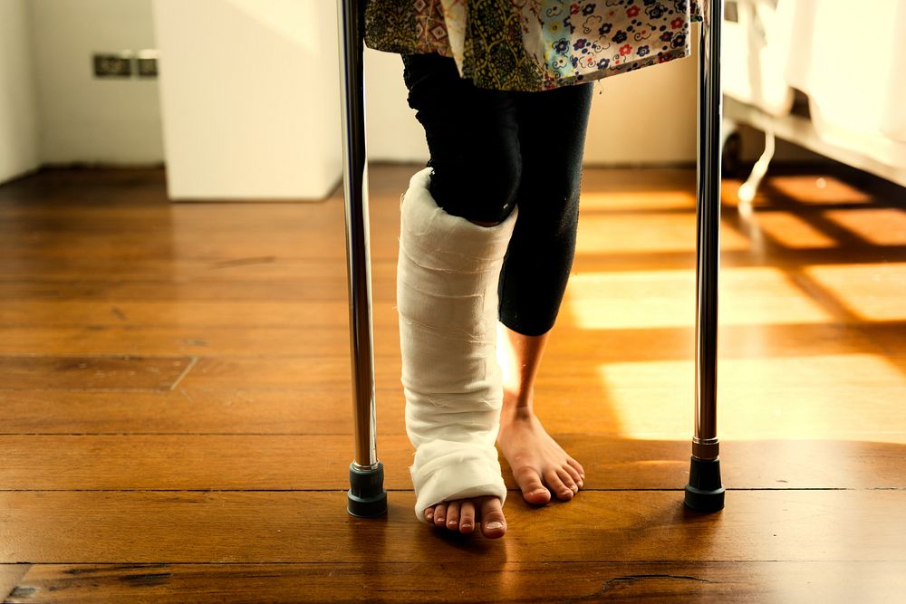 Young girl with a broken leg