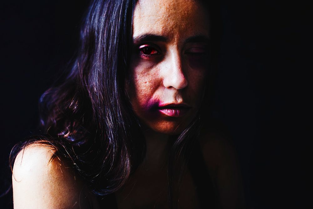 Face portrait of a bruised and beat up woman
