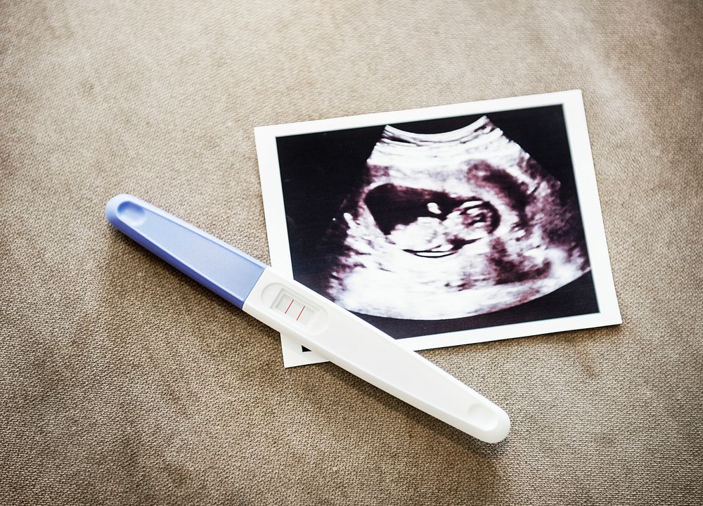 Baby ultrasound scan photo with pregnancy test