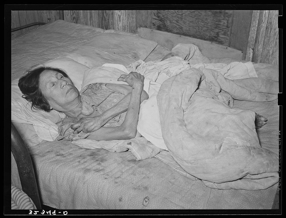 Mexican woman with advanced case of arthritis. Crystal City, Texas. She has been confined to her bed for several years by…