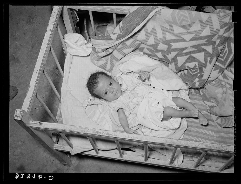 Mexican baby. This child is suffering from malnutrition. Notice the legs and arms. Crystal City, Texas by Russell Lee