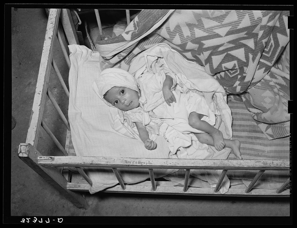 Mexican baby. This child is suffering from malnutrition. Notice the legs and arms. Crystal City, Texas by Russell Lee