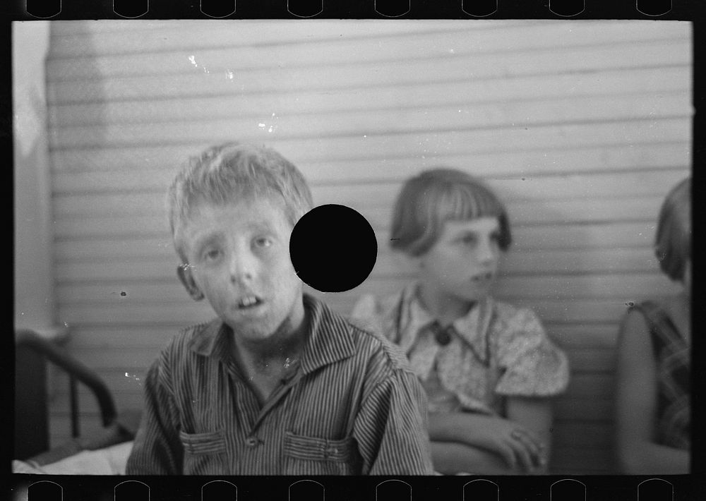 [Untitled photo, possibly related to: Son of Olaf Fugelburg, farmer of Williams County, North Dakota. He has had weeping…