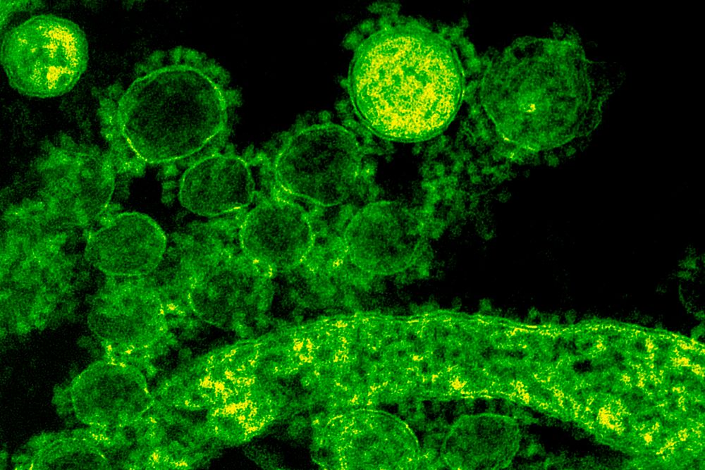 Green coronavirus under a microscope. Original image sourced from US Government department: Public Health Image Library…