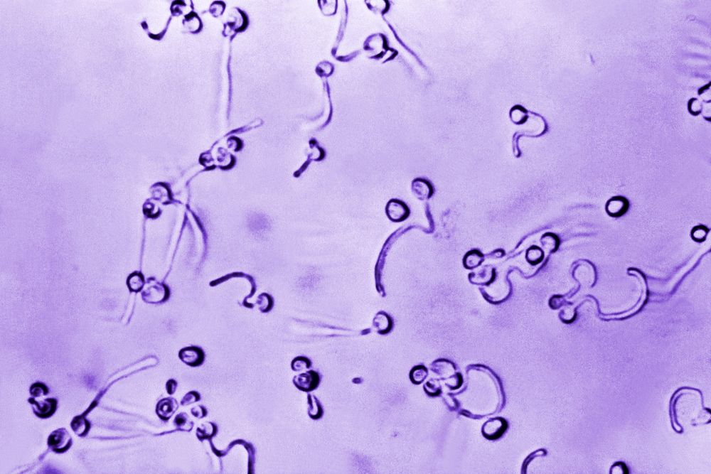 A photomicrograph of Candida albicans fungal spores. Original image sourced from US Government department: Public Health…