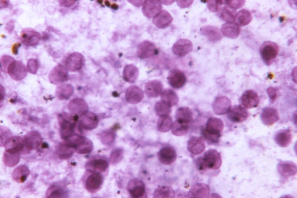 Photomicrograph of a toluidine blue stained lung tissue.