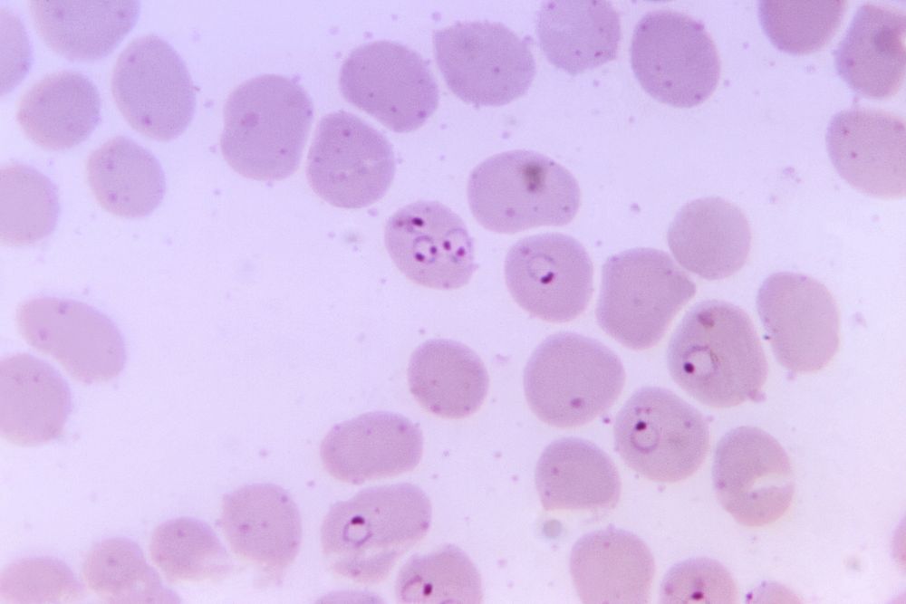 Photomicrograph of a human blood smear. Original image sourced from US Government department: Public Health Image Library…
