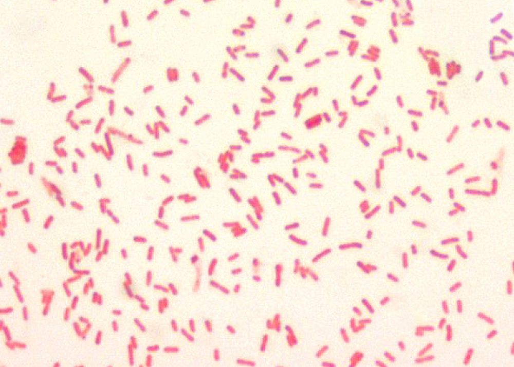 A 1000X photomicrograph magnification of numerous, rod-shaped, Gram&ndash;negative, Yersinia pestis bacilli.