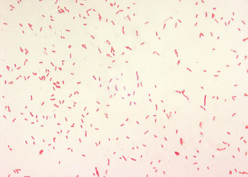 A photomicrograph reveals the presence of numerous, rod-shaped, Gram&ndash;negative, Yersinia pestis bacilli.