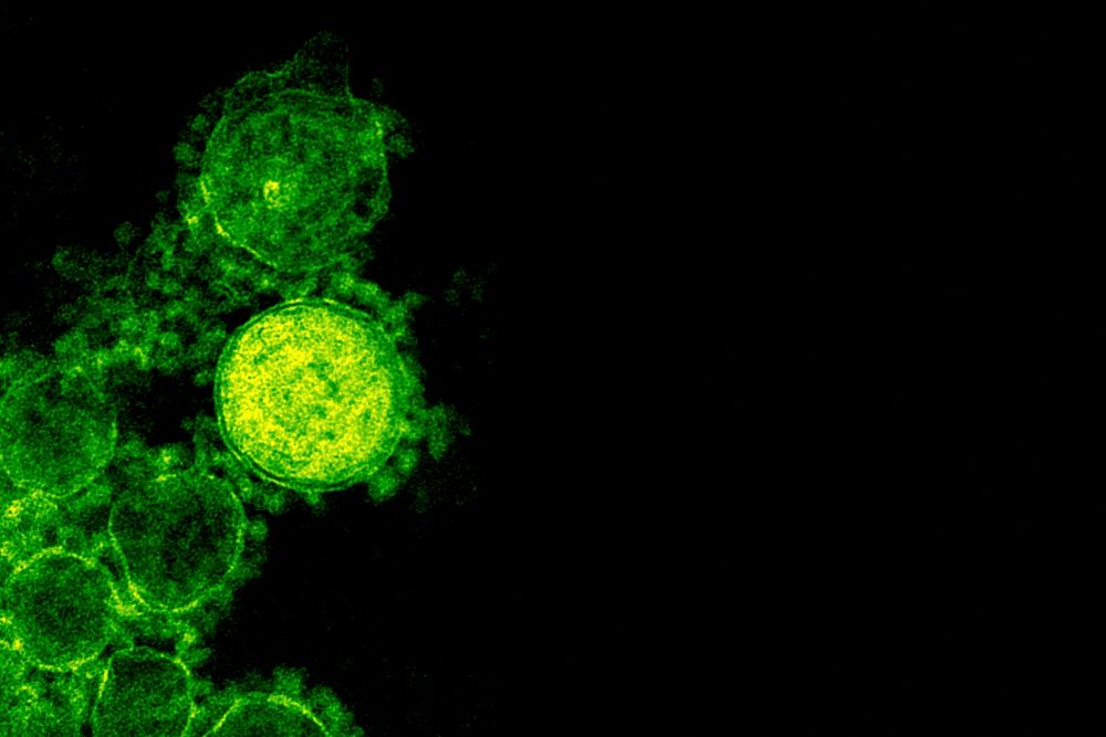 Green coronavirus under a microscope