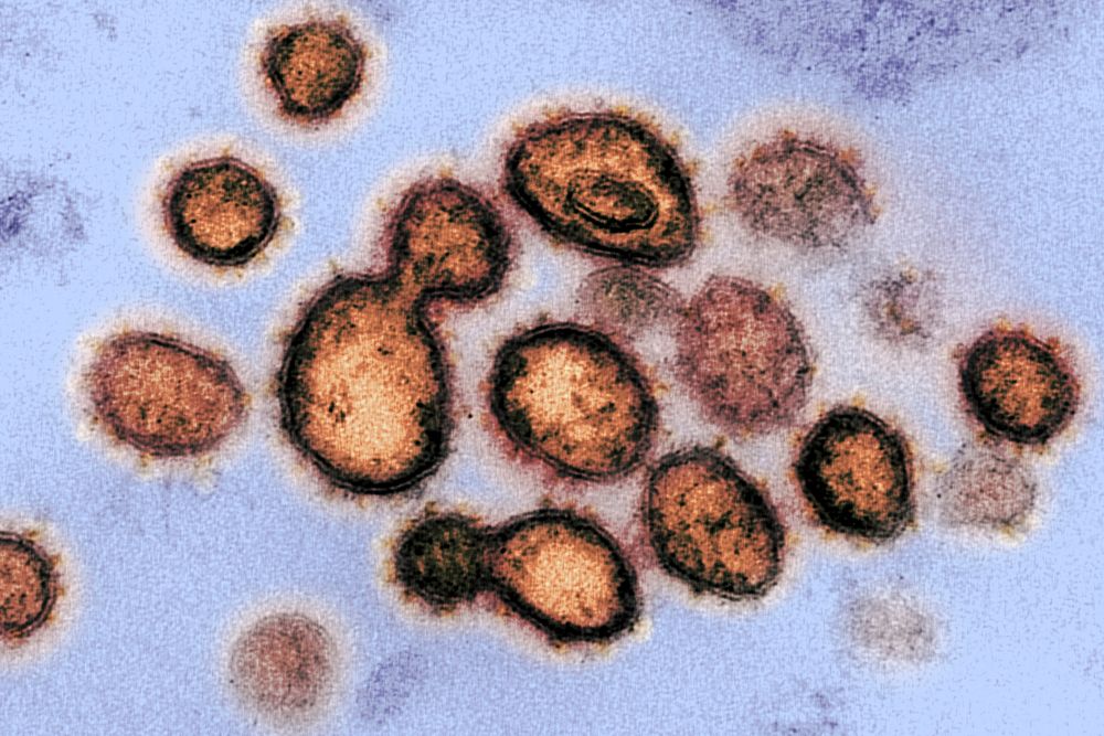 Novel Coronavirus SARS-CoV-2&ndash;This scanning electron microscope image shows SARS-CoV-2&mdash;also known as 2019-nCoV…