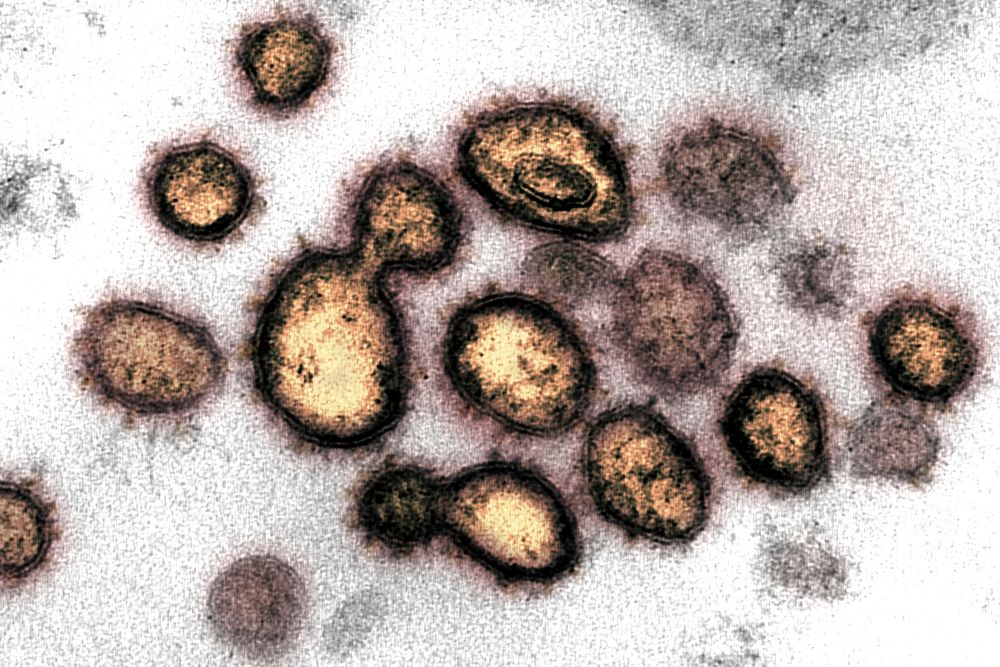 Novel Coronavirus SARS-CoV-2&ndash;This transmission electron microscope image shows SARS-CoV-2, the virus that causes COVID…