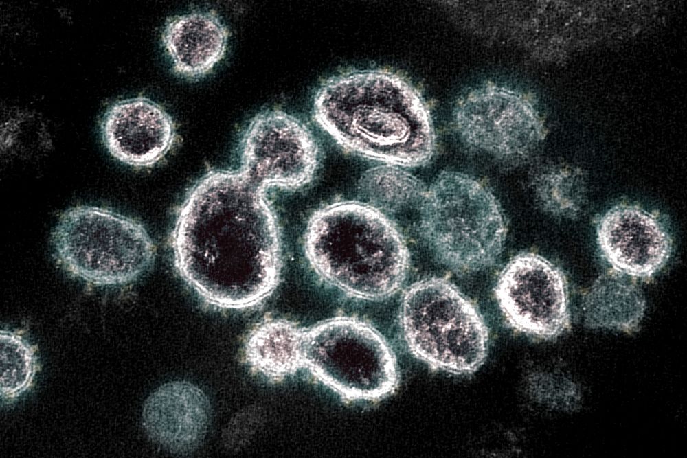 Novel Coronavirus SARS-CoV-2–This transmission electron microscope image shows SARS-CoV-2, the virus that causes COVID-19.…