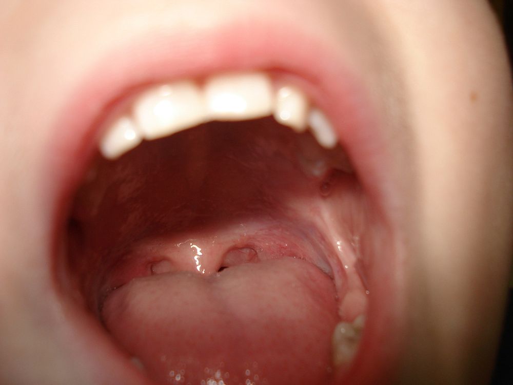 Free kids's mouth image, public domain child CC0 photo.