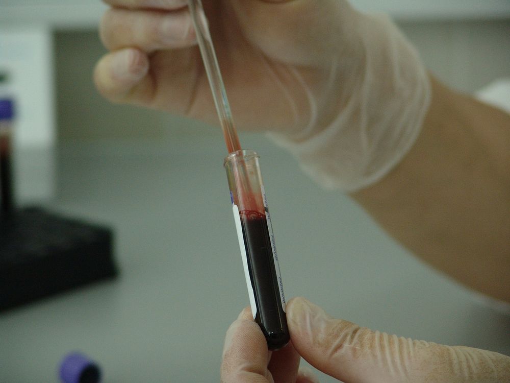 Free blood sample in a tube image, public domain CC0 photo.