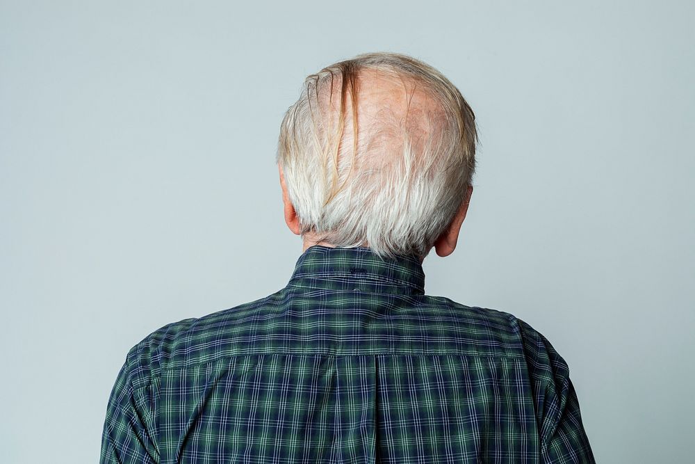 Rear view of a senior man crown balding