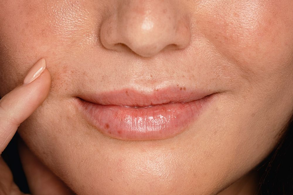 Beautiful freckles close up, on female face