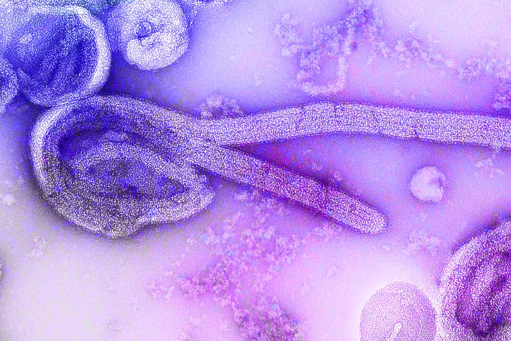 Electron microscopic image of Ebola virus.