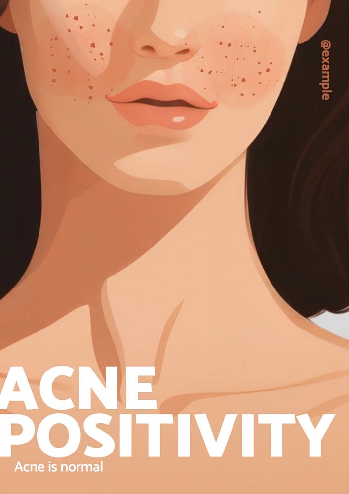 Acne positivity poster template