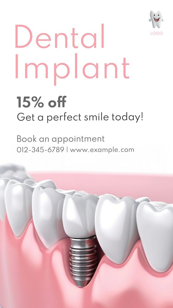 Dental implant inspiration template