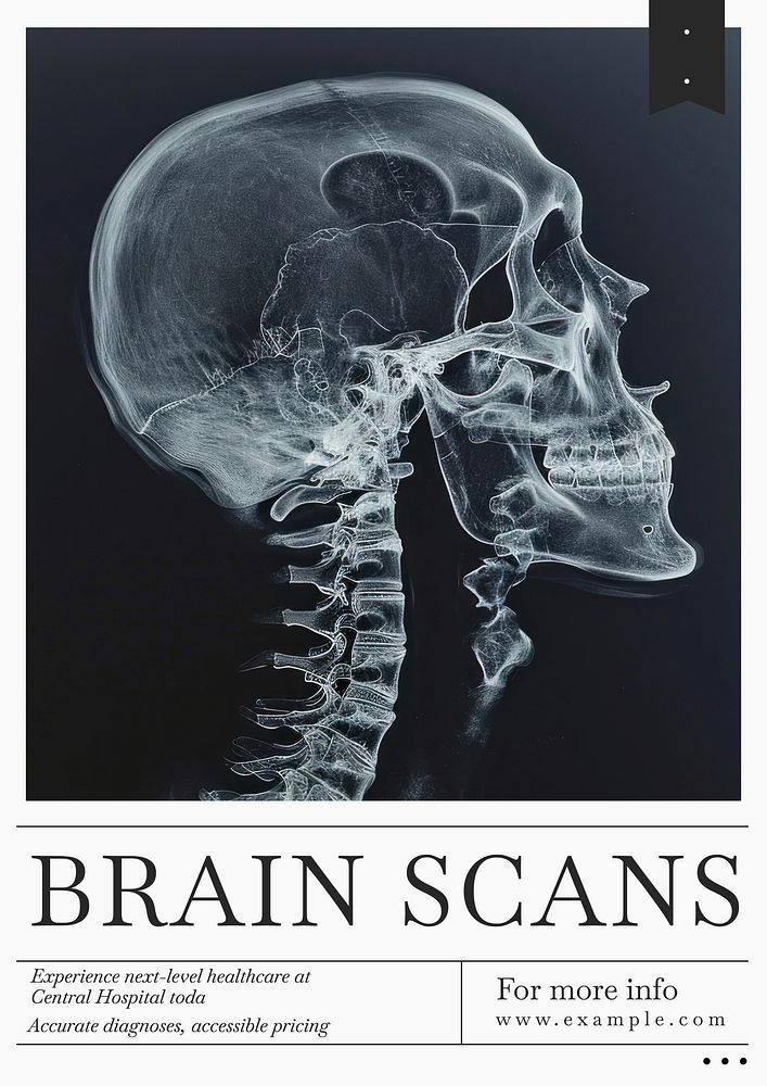 Brain scan poster template