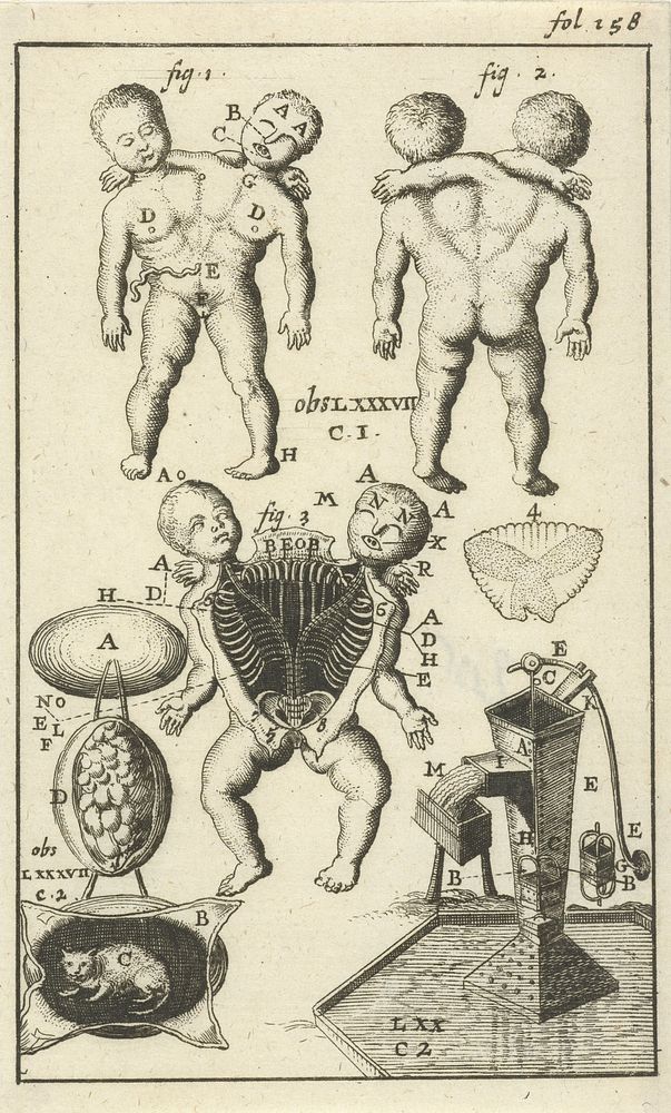 Anatomische afbeelding VI (1680 - 1688) by Jan Luyken and Jan Claesz ten Hoorn