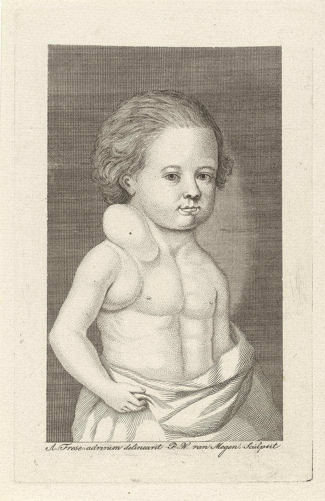 Jongen met een gezwel (1760 - 1785) by Pieter Willem van Megen and Albertus Frese de Jonge