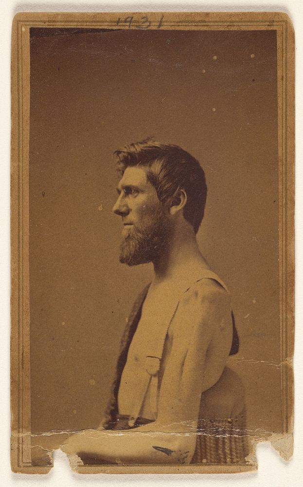 Unidentified Civil War victim in profile, seated by William H Bell