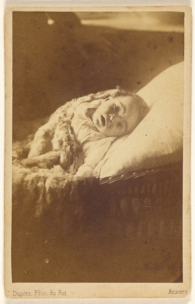 Unidentified child with head turned to the camera, in bassinet by J Dupont