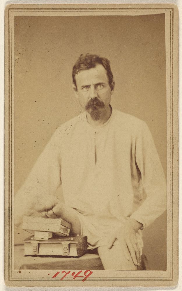 Unidentified Civil War victim with Vandyke beard, right leg amputated by William H Bell
