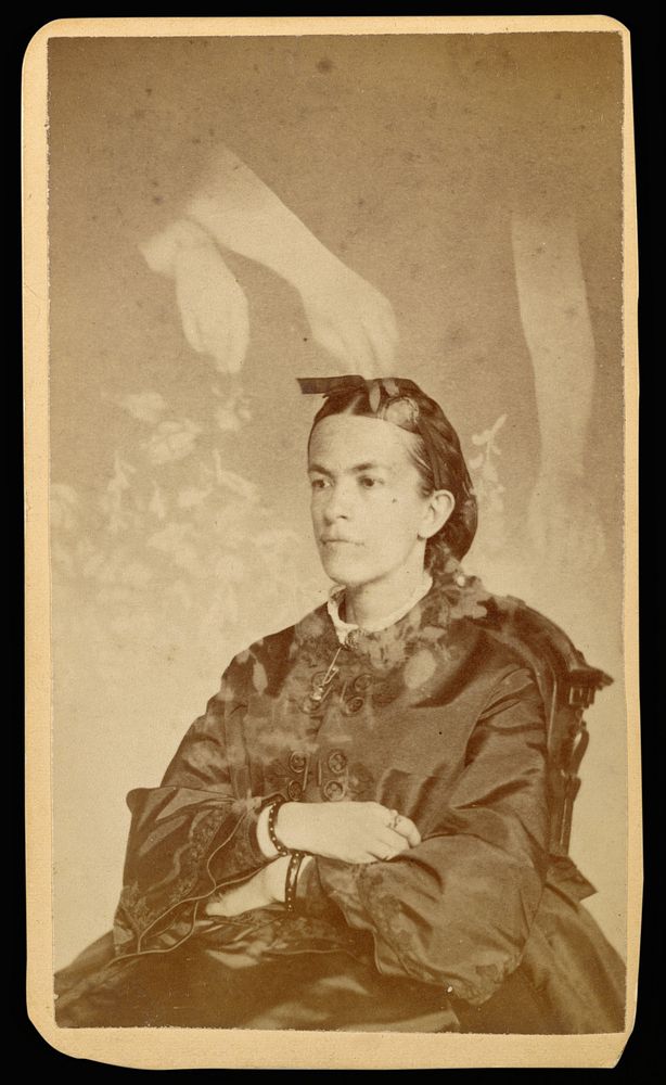 Unidentified woman seated with arms of a "spirit" over her head by William H Mumler