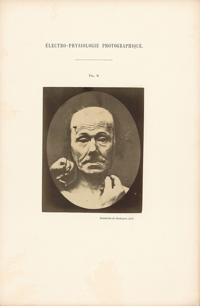 Électro-Physiologie Photographique, Figure 8 by Guillaume Benjamin Duchenne and Adrien Alban Tournachon