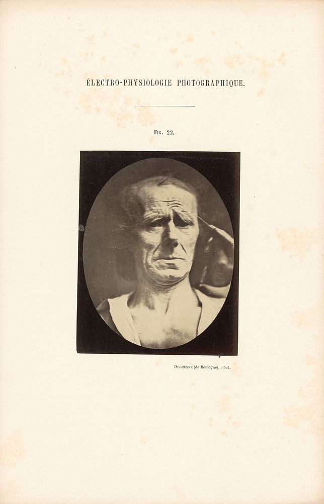 Électro-Physiologie Photographique, Figure 22 by Guillaume Benjamin Duchenne and Adrien Alban Tournachon